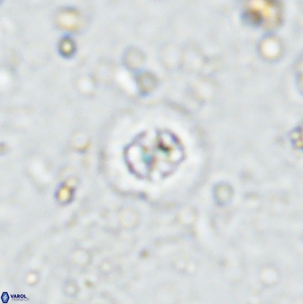 Prediscosphaera cantabrigensis 35899