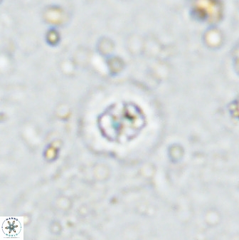 Prediscosphaera cantabrigensis 35899