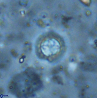 Prediscosphaera cantabrigensis 35900