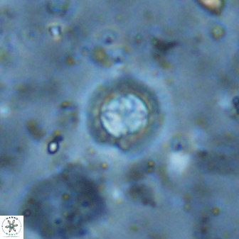 Prediscosphaera cantabrigensis 35900