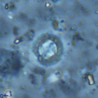 Prediscosphaera cantabrigensis 35901