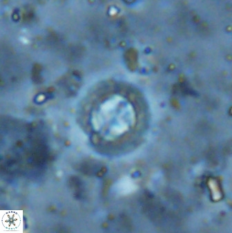 Prediscosphaera cantabrigensis 35901
