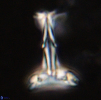 Prediscosphaera cantabrigensis 41095