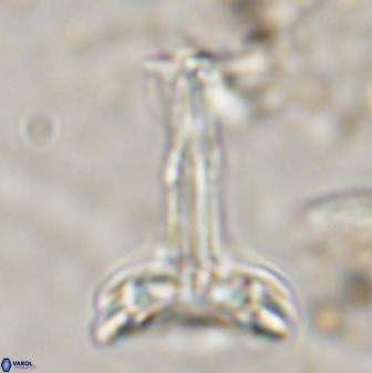 Prediscosphaera cantabrigensis 41097