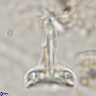 Prediscosphaera cantabrigensis 41098
