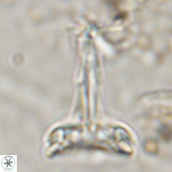 Prediscosphaera cantabrigensis 41098
