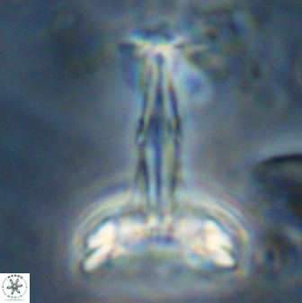 Prediscosphaera cantabrigensis 41099