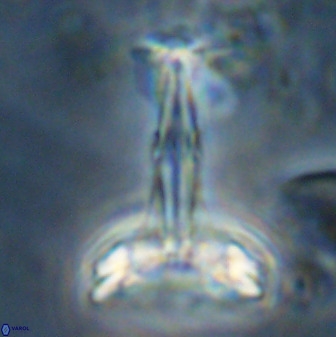 Prediscosphaera cantabrigensis 41100