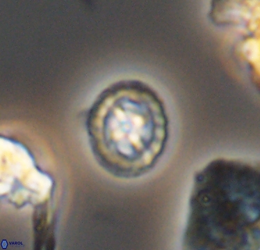 Prediscosphaera cretacea 10406