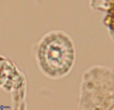 Prediscosphaera cretacea 10407