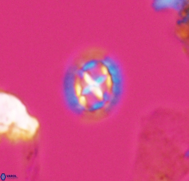 Prediscosphaera cretacea 10409