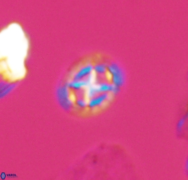 Prediscosphaera cretacea 10413
