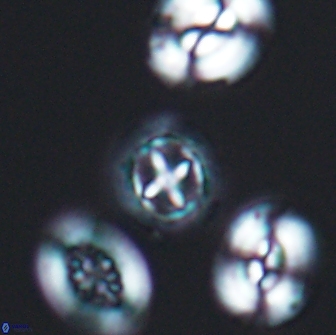 Prediscosphaera cretacea 12975