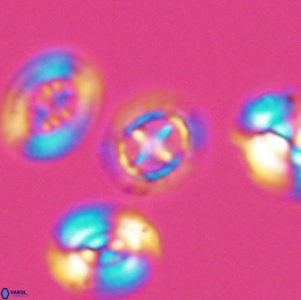 Prediscosphaera cretacea 12978