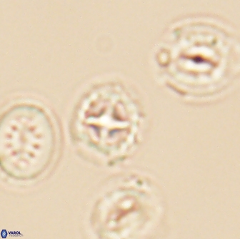 Prediscosphaera cretacea 12979