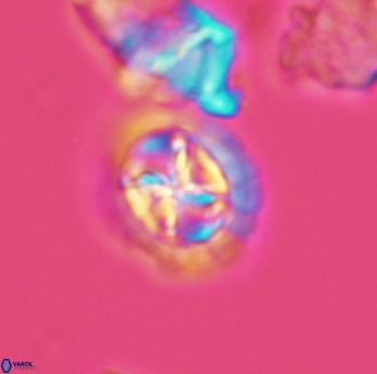 Prediscosphaera cretacea 3072