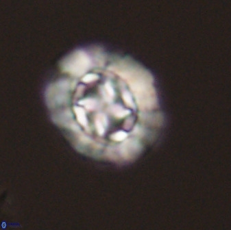 Prediscosphaera cretacea 52301