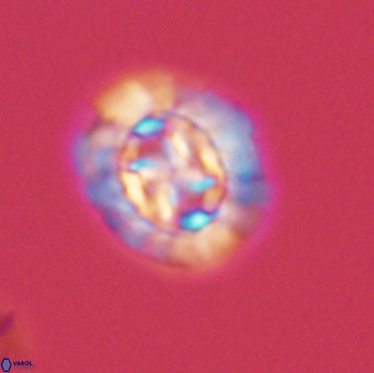 Prediscosphaera cretacea 52302
