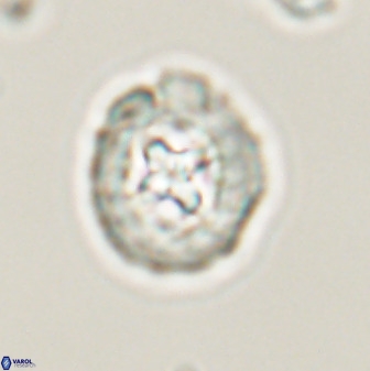 Prediscosphaera cretacea 52303