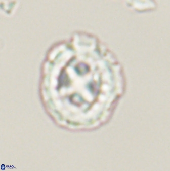Prediscosphaera cretacea 52304