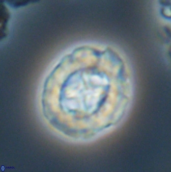 Prediscosphaera cretacea 52308