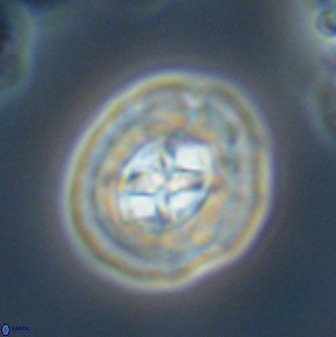 Prediscosphaera cretacea 52309