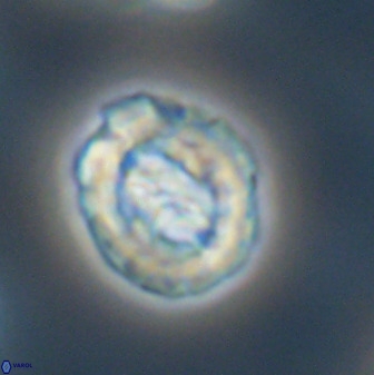 Prediscosphaera cretacea 52310
