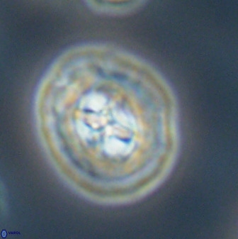 Prediscosphaera cretacea 52311