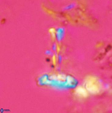 Prediscosphaera cretacea 6057