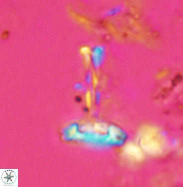 Prediscosphaera cretacea 6057