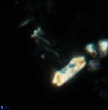 Prediscosphaera cretacea 6058