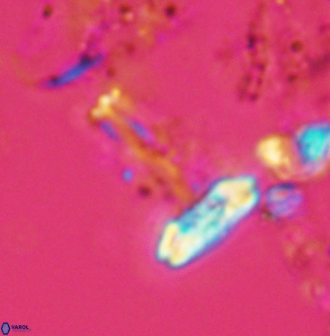 Prediscosphaera cretacea 6059