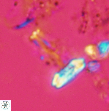 Prediscosphaera cretacea 6059