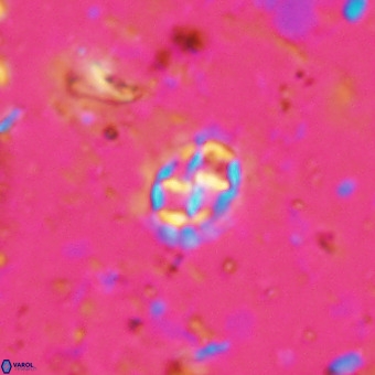 Prediscosphaera cretacea VR 21434
