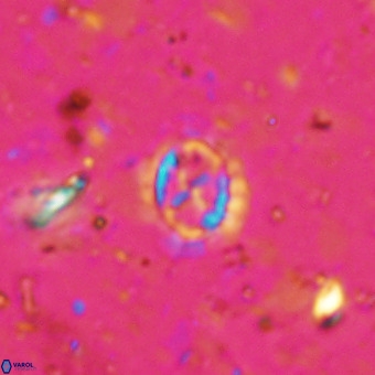 Prediscosphaera cretacea VR 21437