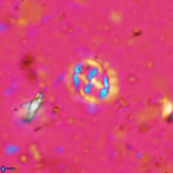 Prediscosphaera cretacea VR 21438
