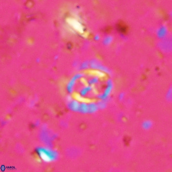 Prediscosphaera cretacea VR 21442