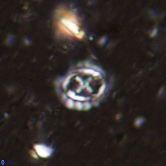 Prediscosphaera cretacea VR 21443