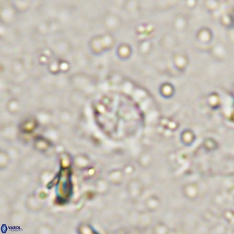 Prediscosphaera cretacea VR 21445