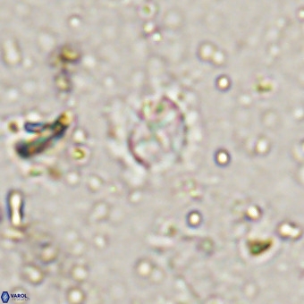 Prediscosphaera cretacea VR 21446