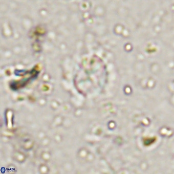 Prediscosphaera cretacea VR 21447