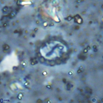 Prediscosphaera cretacea VR 21450