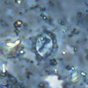 Prediscosphaera cretacea VR 21451