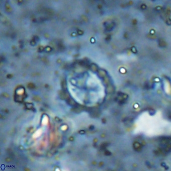 Prediscosphaera cretacea VR 21452