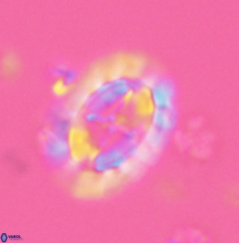Prediscosphaera arkhangelskyi 4884