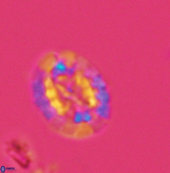 Prediscosphaera arkhangelskyi 4920