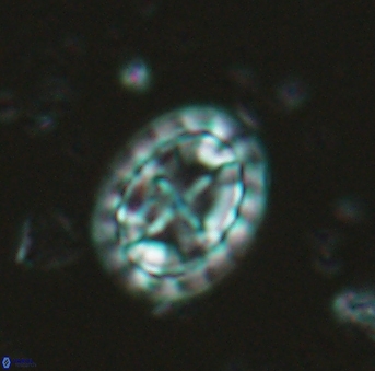 Prediscosphaera arkhangelskyi 4964