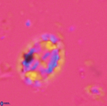 Prediscosphaera arkhangelskyi 4965