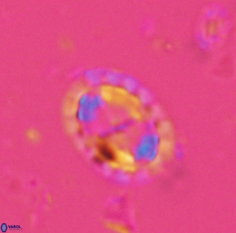 Prediscosphaera arkhangelskyi 4969