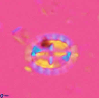 Prediscosphaera arkhangelskyi 4963